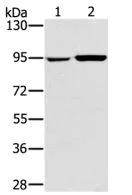 Western blot - Anti-PYGL antibody (AB198268)