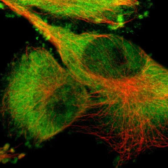 Immunocytochemistry/ Immunofluorescence - Anti-PYGL antibody (AB223788)