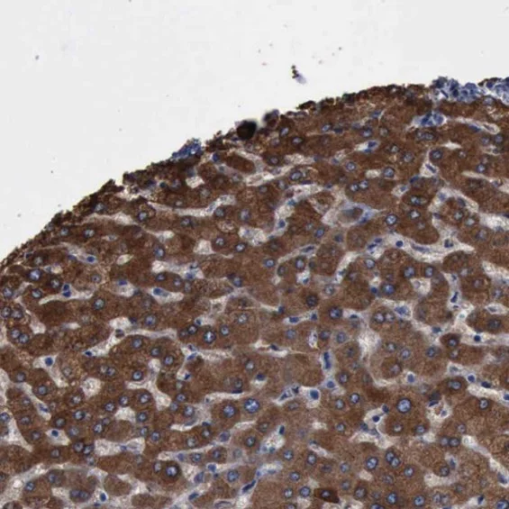 Immunohistochemistry (Formalin/PFA-fixed paraffin-embedded sections) - Anti-PYGL antibody (AB223788)
