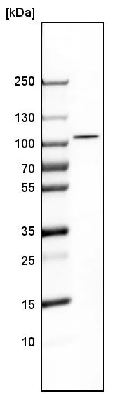 Western blot - Anti-PYGL antibody (AB223788)