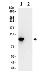 Immunoprecipitation - Anti-PYGL antibody - C-terminal (AB190243)