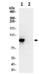Immunoprecipitation - Anti-PYGL antibody - C-terminal (AB190243)