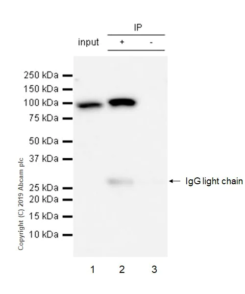 Immunoprecipitation - Anti-PYGL (phospho S15) antibody [EPR20881-72] (AB227043)