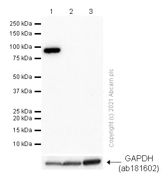 Western blot - Anti-PYGL (phospho S15) antibody [EPR20881-72] (AB227043)