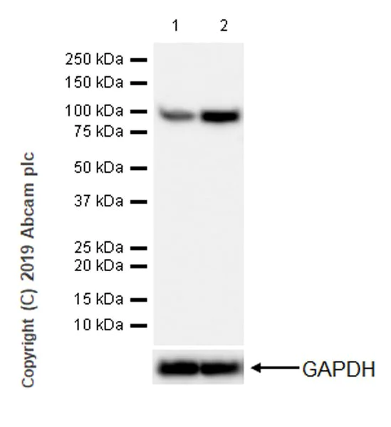 Western blot - Anti-PYGL (phospho S15) antibody [EPR20881-72] (AB227043)