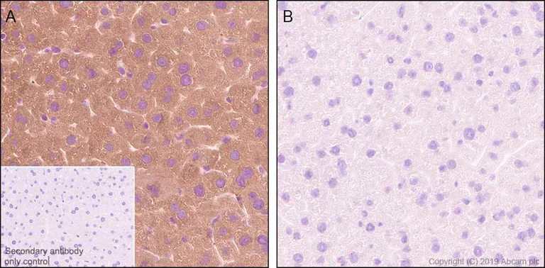 Immunohistochemistry (Formalin/PFA-fixed paraffin-embedded sections) - Anti-PYGL (phospho S15) antibody [EPR20881-72] - BSA and Azide free (AB256553)
