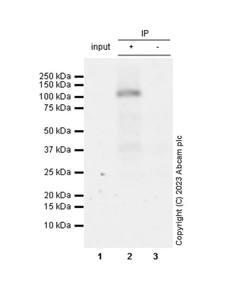 Immunoprecipitation - Anti-PYGL (phospho S430) + PYGM (phospho S430) antibody [EPR20852-26] (AB314428), expandable thumbnail
