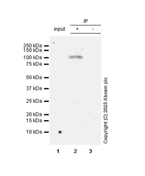 Immunoprecipitation - Anti-PYGL (phospho S430) + PYGM (phospho S430) antibody [EPR20852-26] (AB314428)