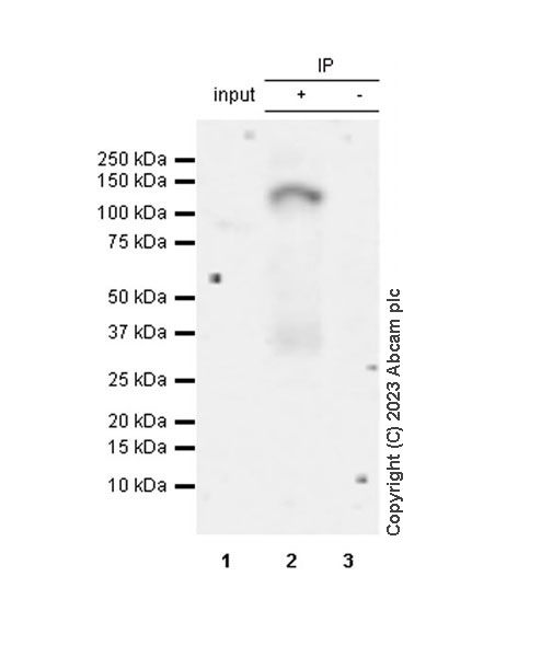 Immunoprecipitation - Anti-PYGL (phospho S430) + PYGM (phospho S430) antibody [EPR20852-26] (AB314428), expandable thumbnail