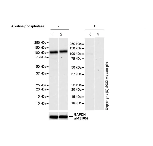 Western blot - Anti-PYGL (phospho S430) + PYGM (phospho S430) antibody [EPR20852-26] (AB314428)