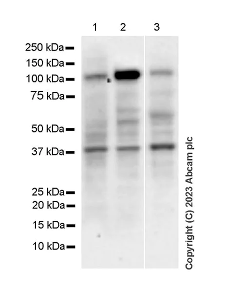 Western blot - Anti-PYGL (phospho S430) + PYGM (phospho S430) antibody [EPR20852-26] (AB314428)