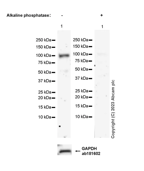 Western blot - Anti-PYGL (phospho S430) + PYGM (phospho S430) antibody [EPR20852-26] - BSA and Azide free (AB314429)