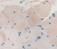 Immunohistochemistry (Formalin/PFA-fixed paraffin-embedded sections) - Anti-PYGM antibody (AB231963)
