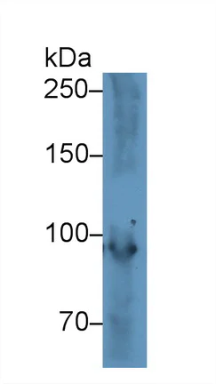 Western blot - Anti-PYGM antibody (AB231963)