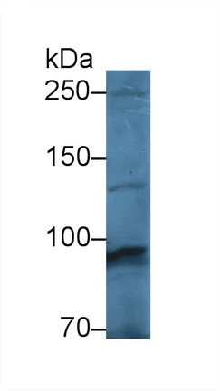Western blot - Anti-PYGM antibody (AB231963)