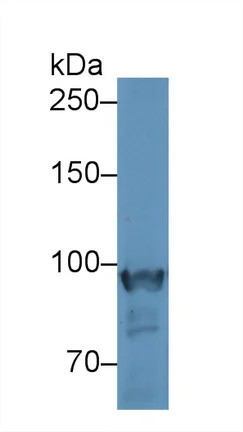 Western blot - Anti-PYGM antibody (AB231963)