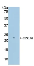 Western blot - Anti-PYGM antibody (AB231963)