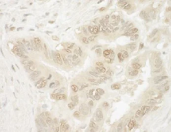 Immunohistochemistry (Formalin/PFA-fixed paraffin-embedded sections) - Anti-PYGO1 antibody (AB128174)
