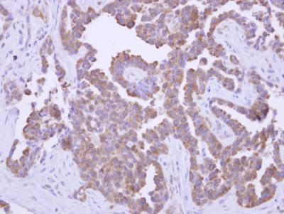 Immunohistochemistry (Formalin/PFA-fixed paraffin-embedded sections) - Anti-PYGO2 antibody (ab155262), expandable thumbnail
