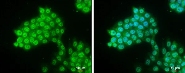 Immunohistochemistry (Formalin/PFA-fixed paraffin-embedded sections) - Anti-PYGO2 antibody (AB155262)