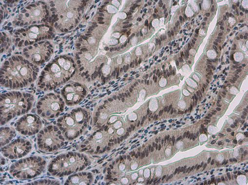 Immunohistochemistry (Formalin/PFA-fixed paraffin-embedded sections) - Anti-PYGO2 antibody (AB155262), expandable thumbnail