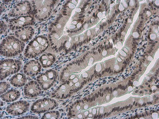 Immunohistochemistry (Formalin/PFA-fixed paraffin-embedded sections) - Anti-PYGO2 antibody (AB155262)