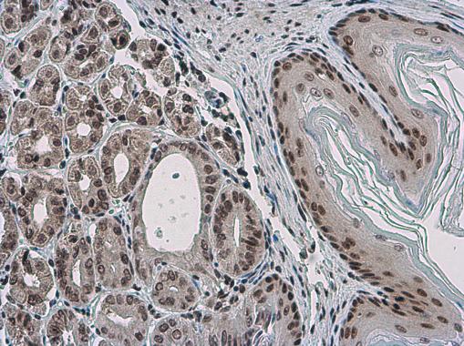 Immunohistochemistry (Formalin/PFA-fixed paraffin-embedded sections) - Anti-PYGO2 antibody (AB155262), expandable thumbnail