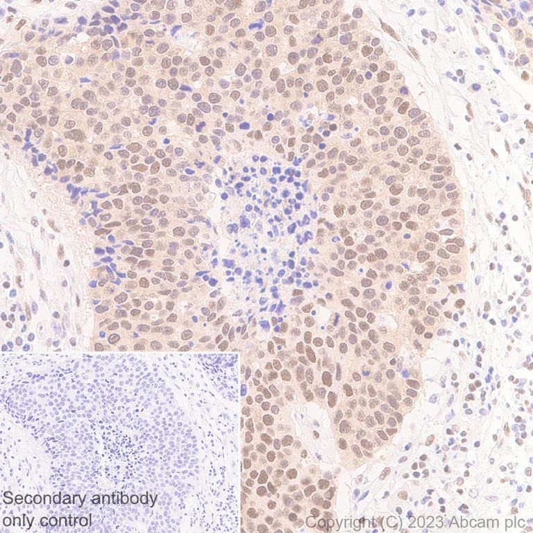 Immunohistochemistry (Formalin/PFA-fixed paraffin-embedded sections) - Anti-PYGO2 antibody [EPR27168-186] (AB316318)