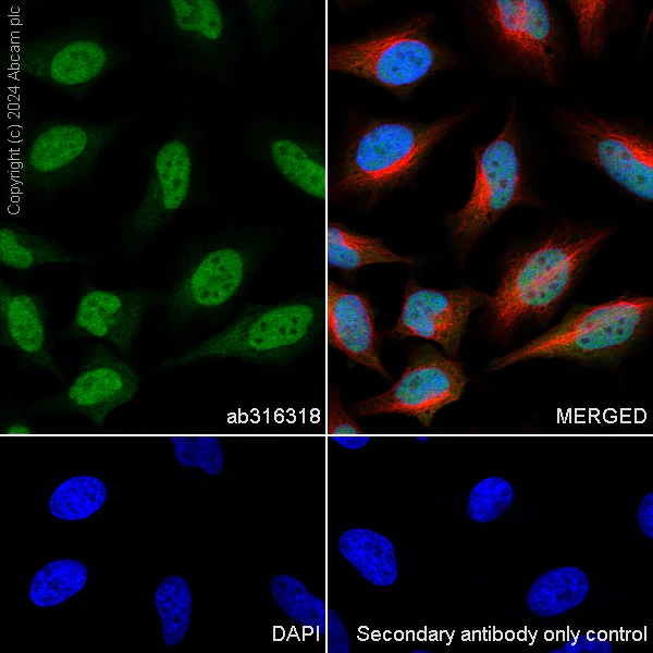 Immunocytochemistry/ Immunofluorescence - Anti-PYGO2 antibody [EPR27168-186] - BSA and Azide free (AB316319)