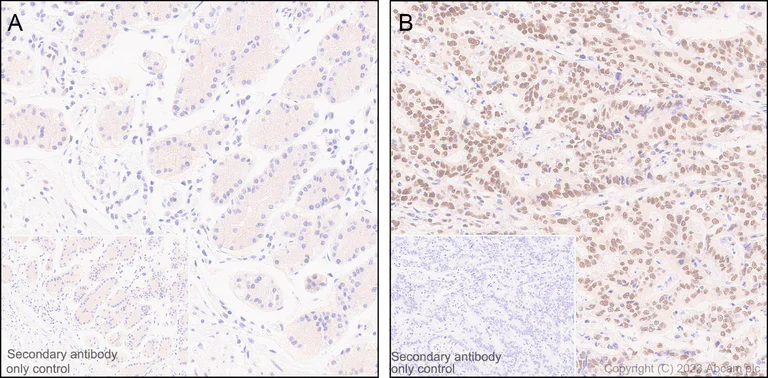 Immunohistochemistry (Formalin/PFA-fixed paraffin-embedded sections) - Anti-PYGO2 antibody [EPR27168-186] - BSA and Azide free (AB316319)