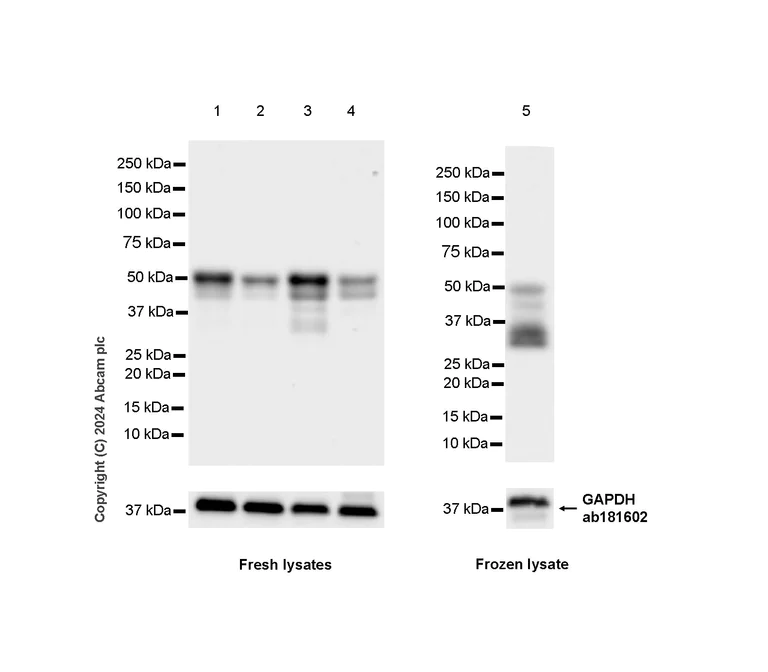 Western blot - Anti-PYGO2 antibody [EPR27168-186] - BSA and Azide free (AB316319)