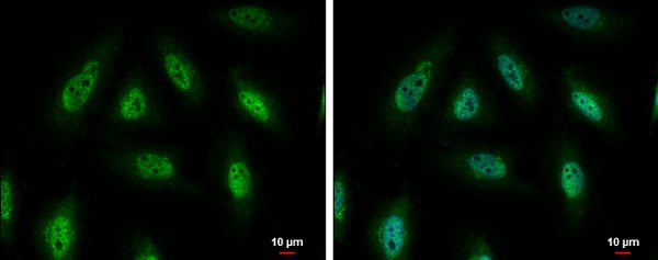 Immunocytochemistry/ Immunofluorescence - Anti-PYK2 antibody (AB226798)