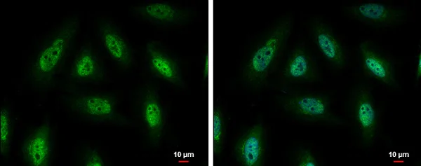 Immunocytochemistry/ Immunofluorescence - Anti-PYK2 antibody (AB226798)