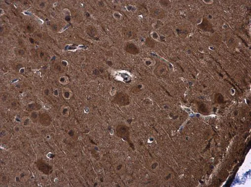 Immunohistochemistry (Formalin/PFA-fixed paraffin-embedded sections) - Anti-PYK2 antibody (AB226798)