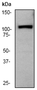 Western blot - Anti-PYK2 antibody [E354] - BSA and Azide free (AB284671), expandable thumbnail