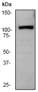 Western blot - Anti-PYK2 antibody [E354] - BSA and Azide free (AB284671)