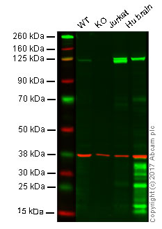 Western blot - Anti-PYK2 antibody [E354] - BSA and Azide free (AB284671), expandable thumbnail