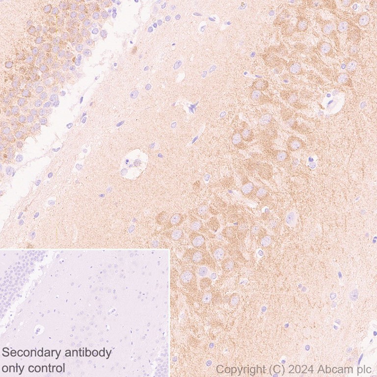 Immunohistochemistry (Formalin/PFA-fixed paraffin-embedded sections) - Anti-PYK2 antibody [EP206Y] (AB81266), expandable thumbnail