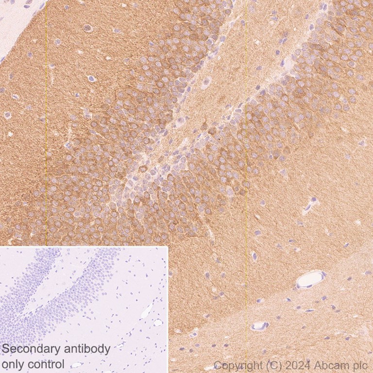 Immunohistochemistry (Formalin/PFA-fixed paraffin-embedded sections) - Anti-PYK2 antibody [EP206Y] (AB81266), expandable thumbnail