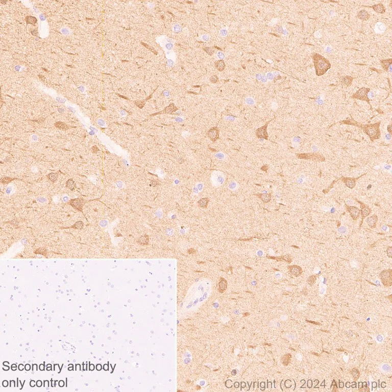 Immunohistochemistry (Formalin/PFA-fixed paraffin-embedded sections) - Anti-PYK2 antibody [EP206Y] - BSA and Azide free (AB284767)