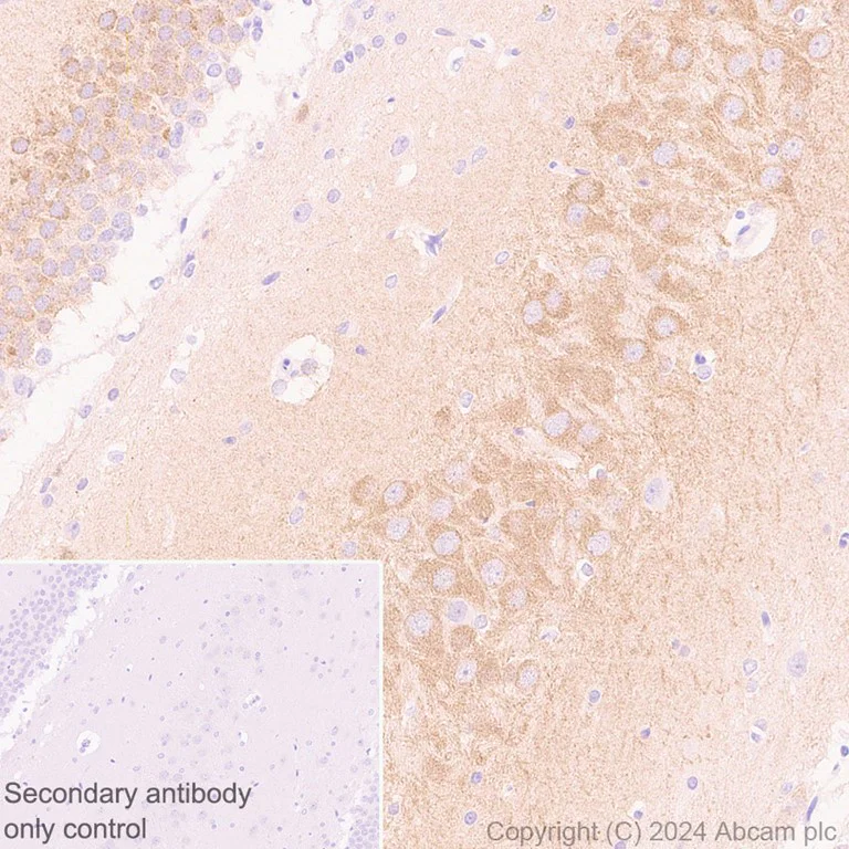 Immunohistochemistry (Formalin/PFA-fixed paraffin-embedded sections) - Anti-PYK2 antibody [EP206Y] - BSA and Azide free (AB284767)