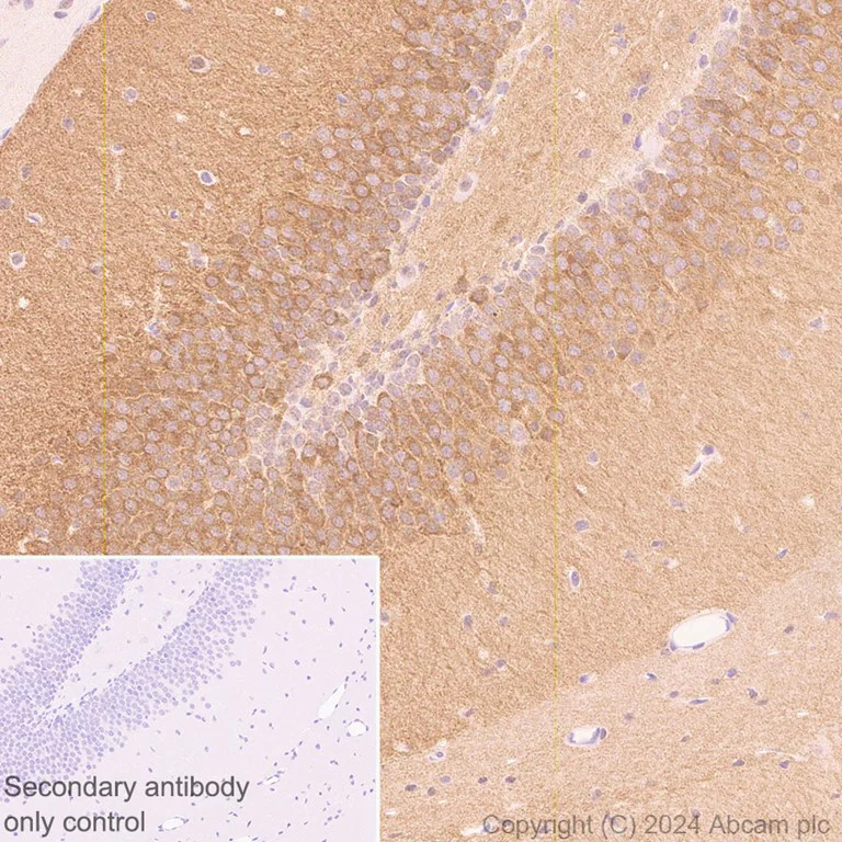 Immunohistochemistry (Formalin/PFA-fixed paraffin-embedded sections) - Anti-PYK2 antibody [EP206Y] - BSA and Azide free (AB284767)