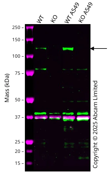 Western blot - Anti-PYK2 antibody [EP206Y] - BSA and Azide free (AB284767)