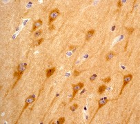 Immunohistochemistry (Formalin/PFA-fixed paraffin-embedded sections) - Anti-PYK2 antibody [YE353] (AB32571)
