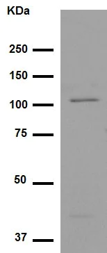 Western blot - Anti-PYK2 antibody [YE353] (AB32571)