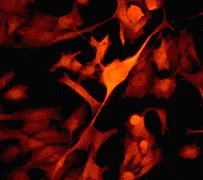 Immunocytochemistry/ Immunofluorescence - Anti-PYK2 antibody [YE353] - BSA and Azide free (AB228477)