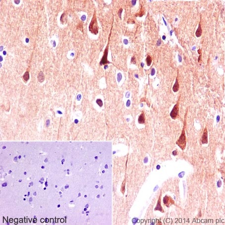 Immunohistochemistry (Formalin/PFA-fixed paraffin-embedded sections) - Anti-PYK2 antibody [YE353] - BSA and Azide free (AB228477), expandable thumbnail