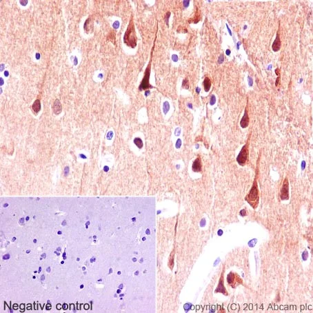 Immunohistochemistry (Formalin/PFA-fixed paraffin-embedded sections) - Anti-PYK2 antibody [YE353] - BSA and Azide free (AB228477)