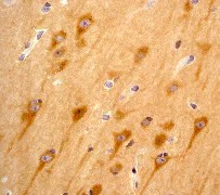 Immunohistochemistry (Formalin/PFA-fixed paraffin-embedded sections) - Anti-PYK2 antibody [YE353] - BSA and Azide free (AB228477)