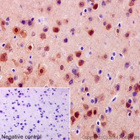 Immunohistochemistry (Formalin/PFA-fixed paraffin-embedded sections) - Anti-PYK2 antibody [YE353] - BSA and Azide free (AB228477)